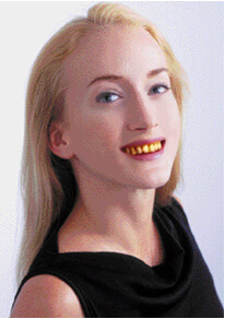 歯の黄ばみの原因と対処法